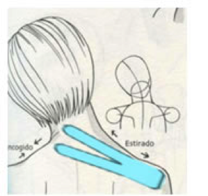 trapecio_superior_venda